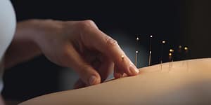 Dry Needling Benefits: What Chiropractors Want You to Know